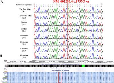 Prenatal diagnosis of recurrent moderate skeletal dysplasias in lamin B receptors